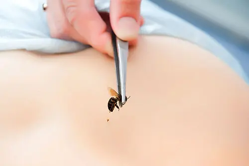 apitherapy